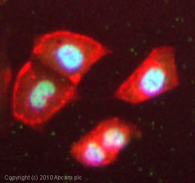 Immunocytochemistry/ Immunofluorescence - Anti-PPAR gamma antibody (AB59256)