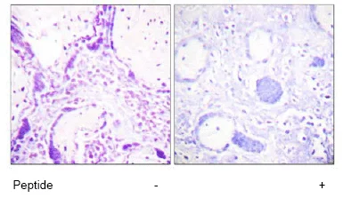 Immunohistochemistry (Formalin/PFA-fixed paraffin-embedded sections) - Anti-PPAR gamma antibody (AB59256)