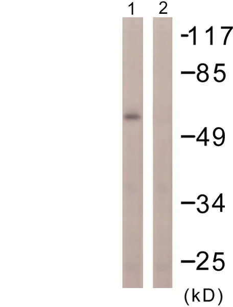 Western blot - Anti-PPAR gamma antibody (AB59256)