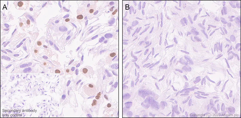 Immunohistochemistry (Formalin/PFA-fixed paraffin-embedded sections) - Anti-PPAR gamma antibody [EPR25862-79] (AB310323)
