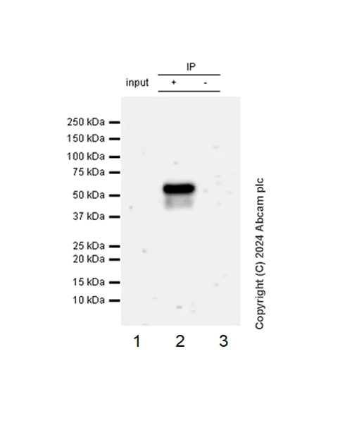 Immunoprecipitation - Anti-PPAR gamma antibody [RM1091] (AB316981)