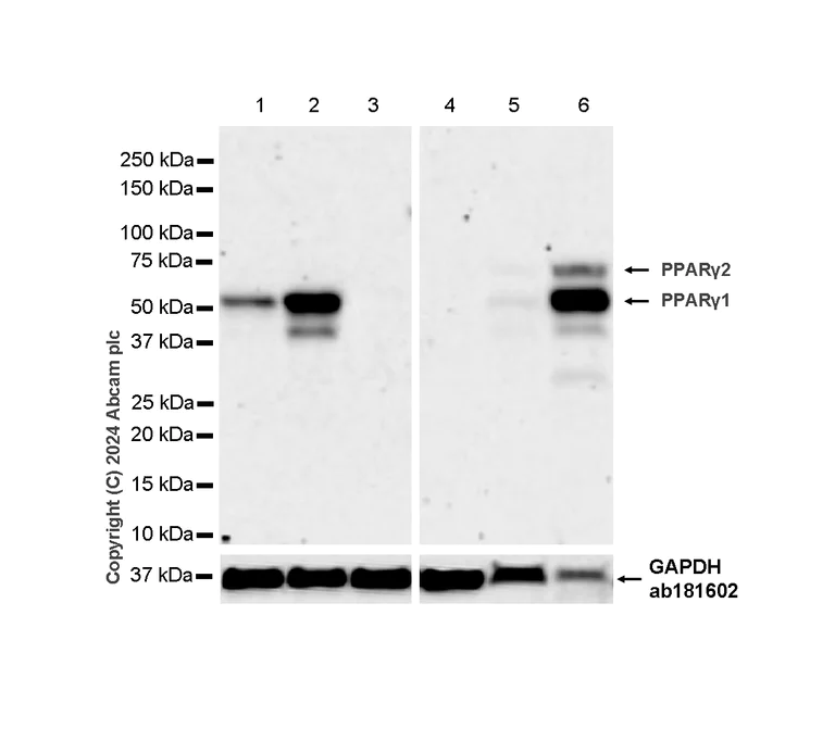Anti-PPAR gamma antibody [RM1091] (ab316981) | Abcam
