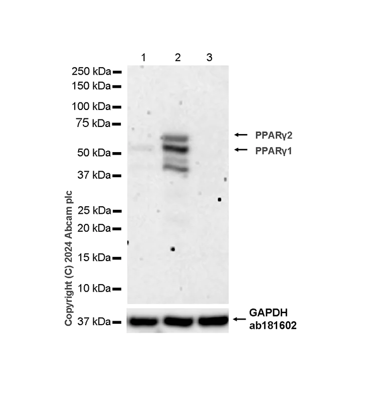 Western blot - Anti-PPAR gamma antibody [RM1091] (AB316981)