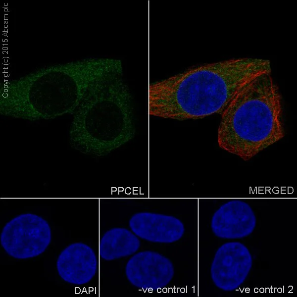 Immunocytochemistry/ Immunofluorescence - Anti-PPCEL/PREPL antibody [EPR17751] (AB202064)