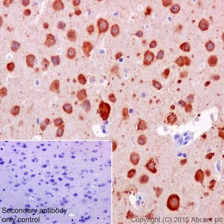 Immunohistochemistry (Formalin/PFA-fixed paraffin-embedded sections) - Anti-PPCEL/PREPL antibody [EPR17752] (AB203111)
