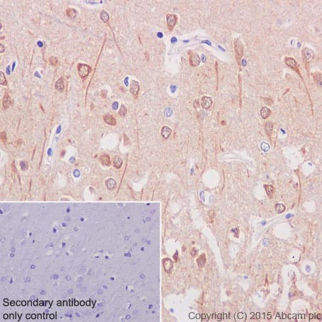 Immunohistochemistry (Formalin/PFA-fixed paraffin-embedded sections) - Anti-PPCEL/PREPL antibody [EPR17752] (AB203111)