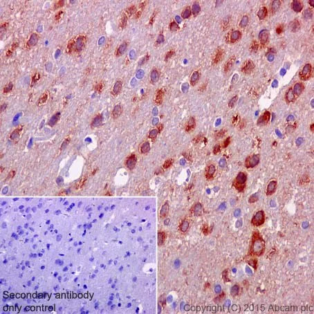 Immunohistochemistry (Formalin/PFA-fixed paraffin-embedded sections) - Anti-PPCEL/PREPL antibody [EPR17752] (AB203111)