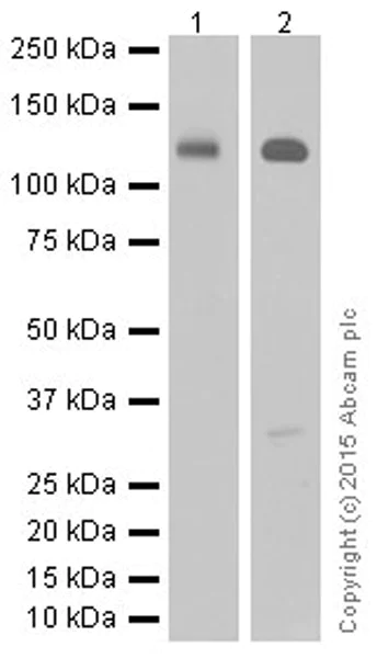 Western blot - Anti-PPCEL/PREPL antibody [EPR17752] - BSA and Azide free (AB251393)