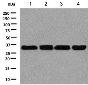 Western blot - Anti-PPCS antibody [EPR9453] - BSA and Azide free (AB175048)