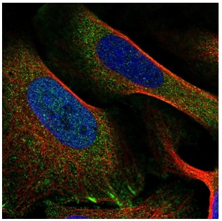 Immunocytochemistry/ Immunofluorescence - Anti-PPFIA1 antibody (AB204406), expandable thumbnail