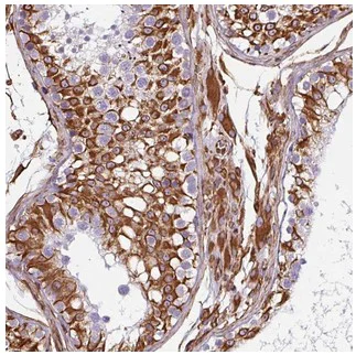 Immunohistochemistry (Formalin/PFA-fixed paraffin-embedded sections) - Anti-PPFIA1 antibody (AB204406)