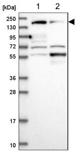 Western blot - Anti-PPFIA1 antibody (AB204406), expandable thumbnail