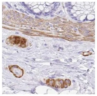 Immunohistochemistry (Formalin/PFA-fixed paraffin-embedded sections) - Anti-PPFIA4 antibody (AB188147)