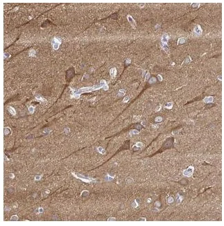 Immunohistochemistry (Formalin/PFA-fixed paraffin-embedded sections) - Anti-PPFIA4 antibody (AB188147)