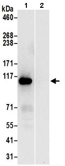 Immunoprecipitation - Anti-PPFIBP1 antibody (AB195339)