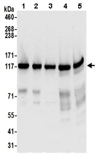Western blot - Anti-PPFIBP1 antibody (AB195339)