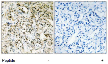 Immunohistochemistry (Formalin/PFA-fixed paraffin-embedded sections) - Anti-PPHLN1/Periphilin-1 antibody (AB69569)
