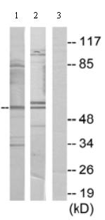 Western blot - Anti-PPHLN1/Periphilin-1 antibody (AB69569)