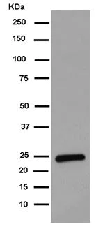 Western blot - Anti-PPIC antibody [EPR15355] - BSA and Azide free (AB250754)