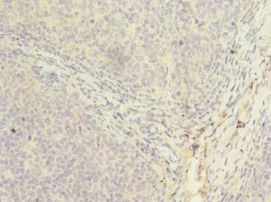 Immunohistochemistry (Formalin/PFA-fixed paraffin-embedded sections) - Anti-PPIH antibody (AB235595)