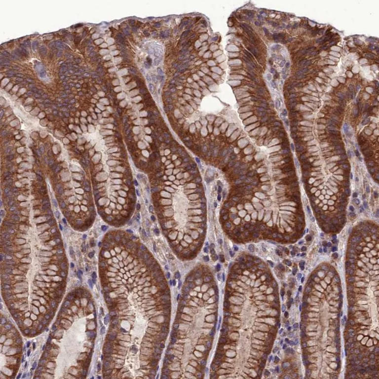 Immunohistochemistry (Formalin/PFA-fixed paraffin-embedded sections) - Anti-PPIL3 antibody (AB251870)