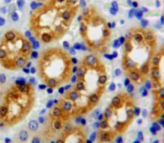 Immunohistochemistry (Formalin/PFA-fixed paraffin-embedded sections) - Anti-PPM1A antibody (AB231893)