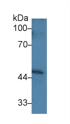 Western blot - Anti-PPM1A antibody (AB231893)