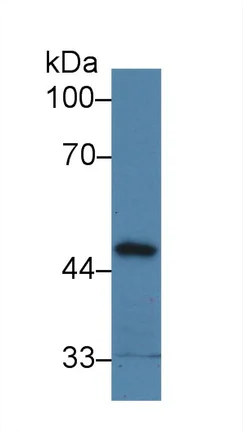 Western blot - Anti-PPM1A antibody (AB231893)