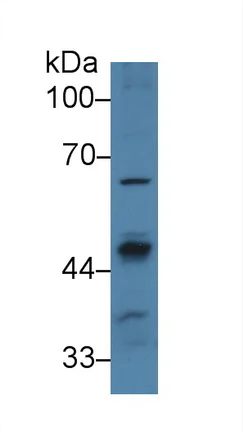 Western blot - Anti-PPM1A antibody (AB231893)