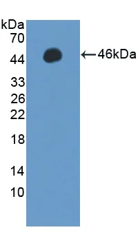 Western blot - Anti-PPM1A antibody (AB231893)