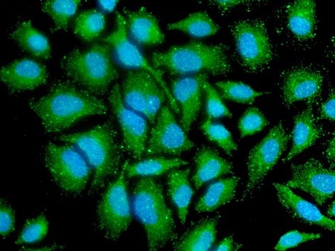 Anti-PPM1A antibody [p6c7]