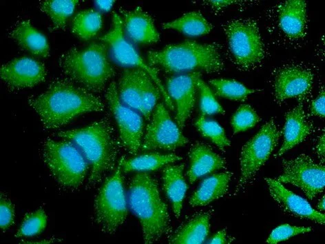 Immunocytochemistry/ Immunofluorescence - Anti-PPM1A antibody [p6c7] (AB14824)