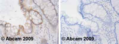 Immunohistochemistry (Formalin/PFA-fixed paraffin-embedded sections) - Anti-PPM1A antibody [p6c7] (AB14824)
