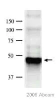 Western blot - Anti-PPM1A antibody [p6c7] (AB14824)