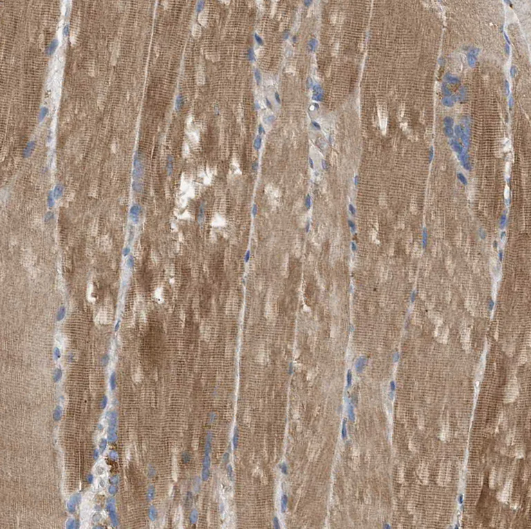 Immunohistochemistry (Formalin/PFA-fixed paraffin-embedded sections) - Anti-PPM1B antibody (AB244353)