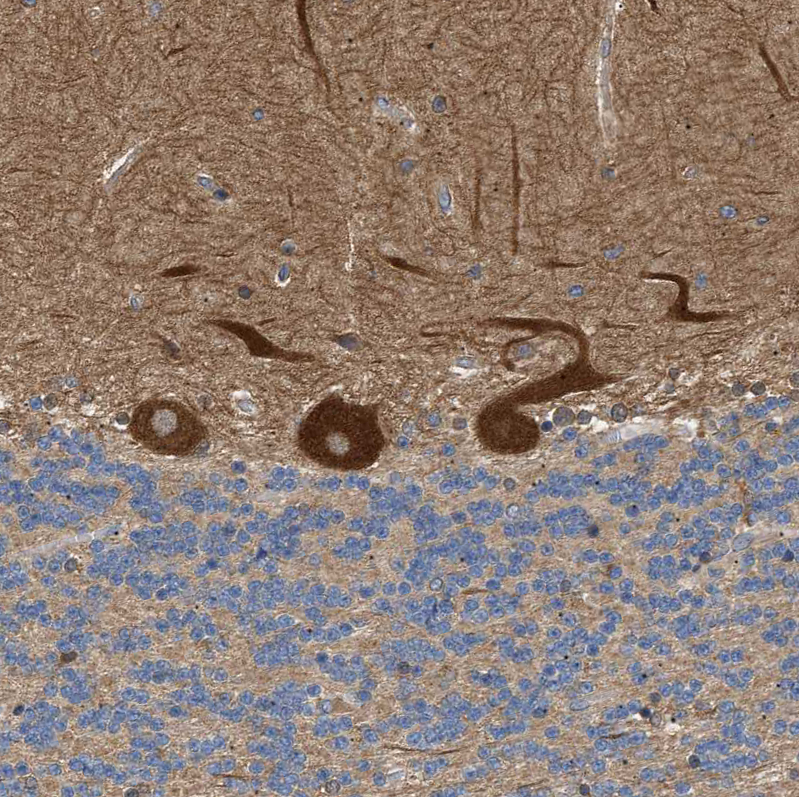 Immunohistochemistry (Formalin/PFA-fixed paraffin-embedded sections) - Anti-PPM1B antibody (AB244353)