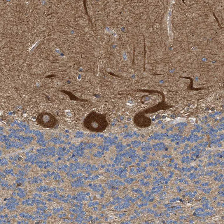 Immunohistochemistry (Formalin/PFA-fixed paraffin-embedded sections) - Anti-PPM1B antibody (AB244353)