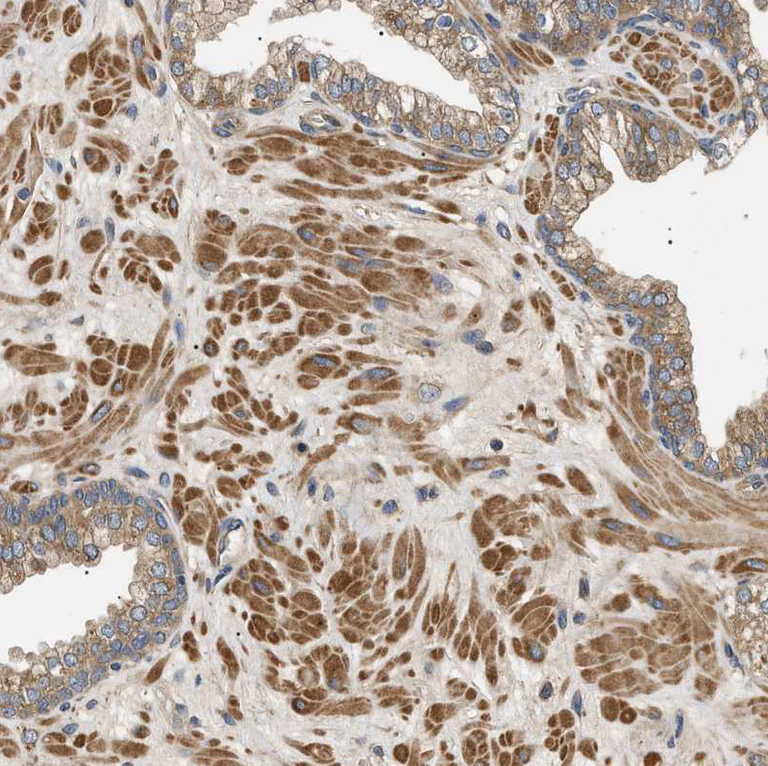 Immunohistochemistry (Formalin/PFA-fixed paraffin-embedded sections) - Anti-PPM1B antibody (AB244353)