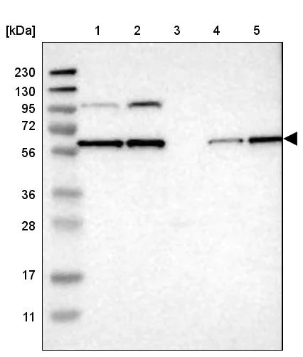 Western blot - Anti-PPM1B antibody (AB244353)
