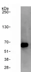 Immunoprecipitation - Anti-PPM1B antibody (AB70804)