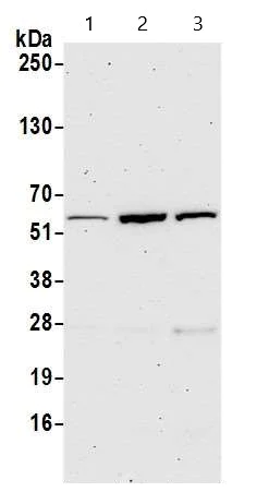 Western blot - Anti-PPM1B antibody (AB70804)
