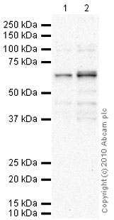 Western blot - Anti-PPM1D/WIP1 antibody (AB31270), expandable thumbnail