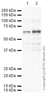 Western blot - Anti-PPM1D/WIP1 antibody (AB31270)