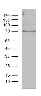 Western blot - Anti-PPM1D/WIP1 antibody [OTI3E1] (AB236515)