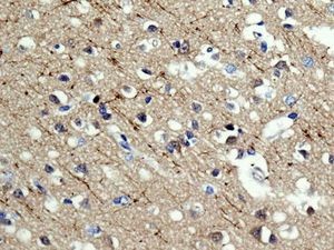 Immunohistochemistry (Formalin/PFA-fixed paraffin-embedded sections) - Anti-PPM1E antibody [EPR8721] (AB137122), expandable thumbnail