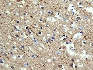 Immunohistochemistry (Formalin/PFA-fixed paraffin-embedded sections) - Anti-PPM1E antibody [EPR8721] (AB137122)