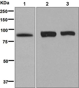 Western blot - Anti-PPM1E antibody [EPR8722] (AB137023), expandable thumbnail