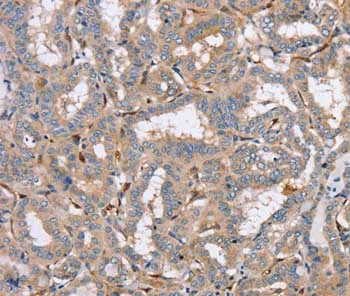 Immunohistochemistry (Formalin/PFA-fixed paraffin-embedded sections) - Anti-PPM1F/POPX2 antibody (AB200394)