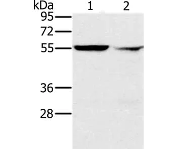 Western blot - Anti-PPM1F/POPX2 antibody (AB200394)