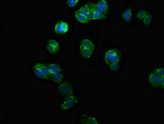 Immunocytochemistry/ Immunofluorescence - Anti-PPM1F/POPX2 antibody (AB236884)